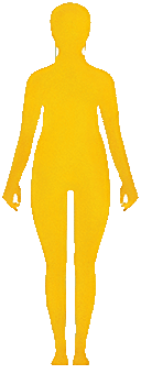 BMI国际WHO标准偏胖范围25.0 ~ 29.9